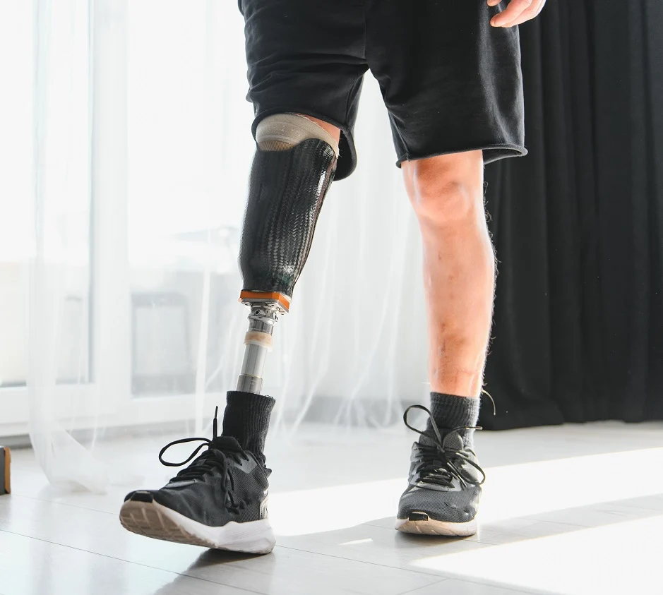 below-knee amputee supplies