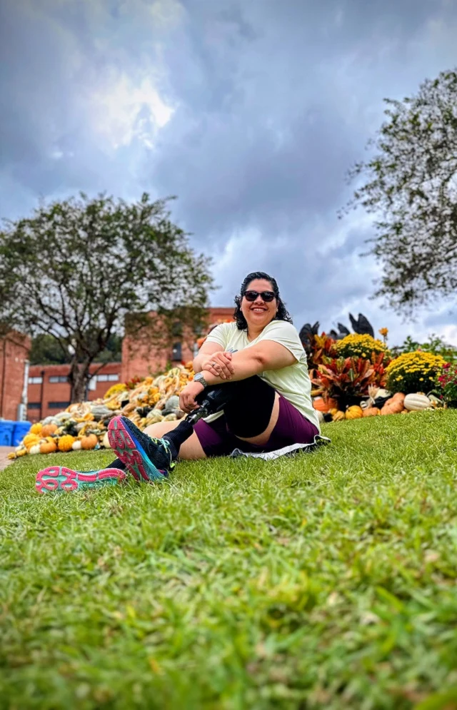 Mary: Custom Below-Knee Prosthetic After CRPS