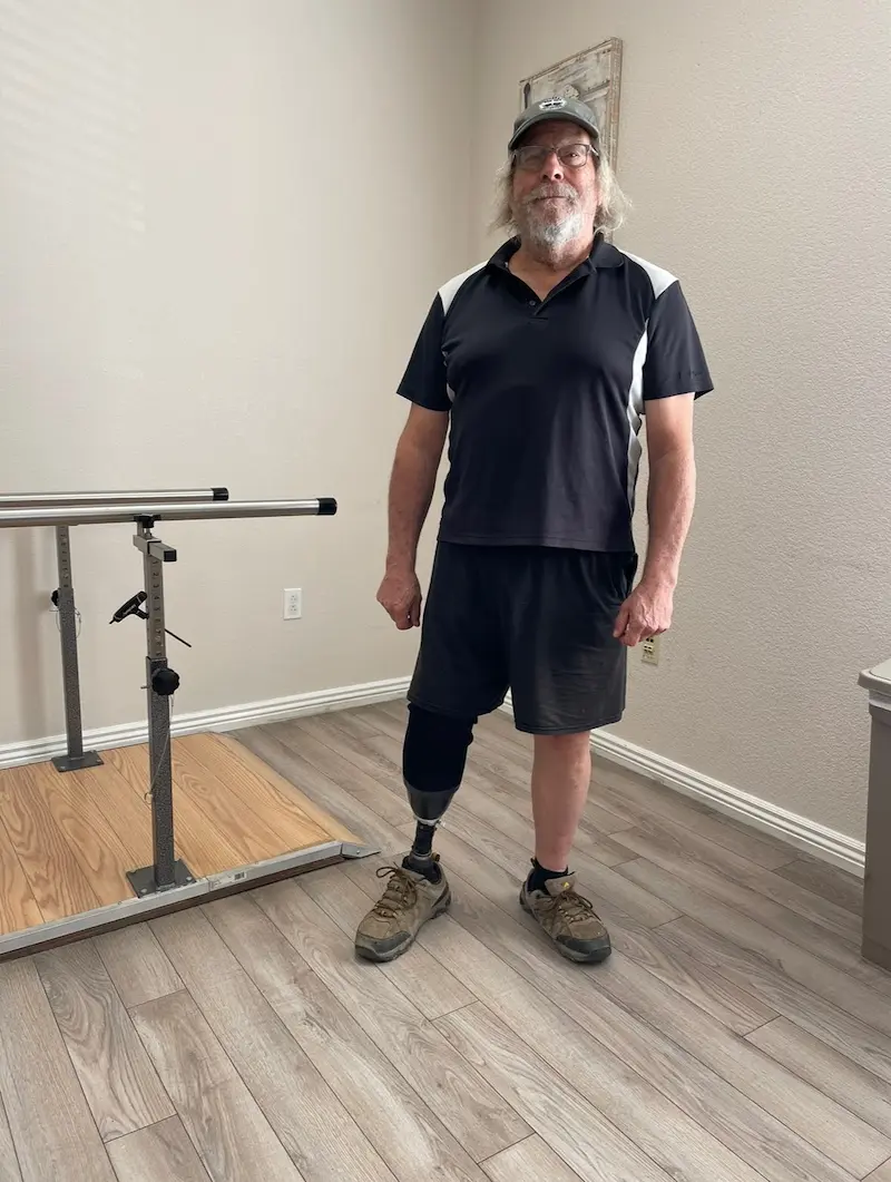 overcoming osteomyelitis through prosthetics