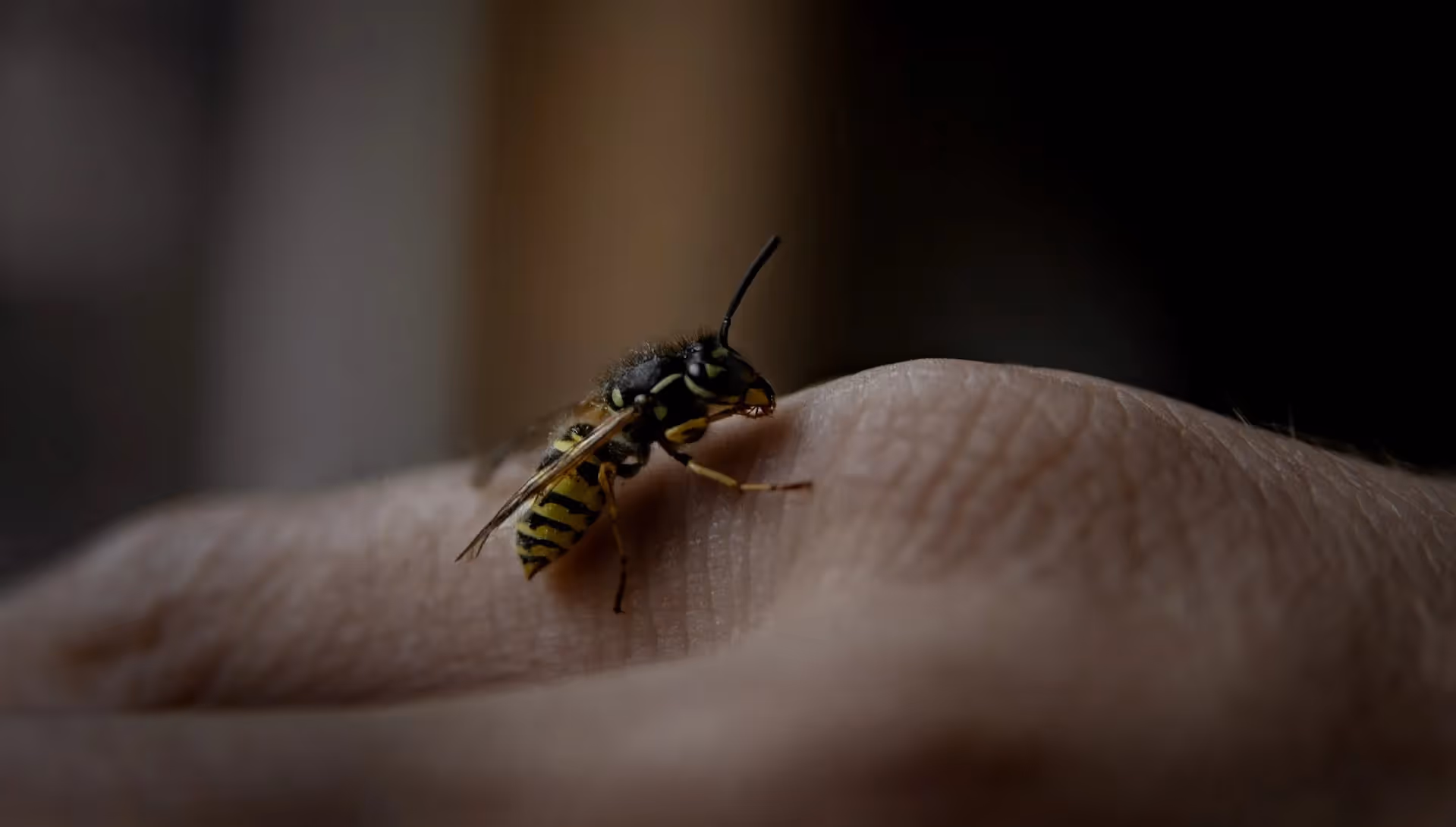 Att behandla getingstick på barn handlar ofta om att dämpa smärtan
