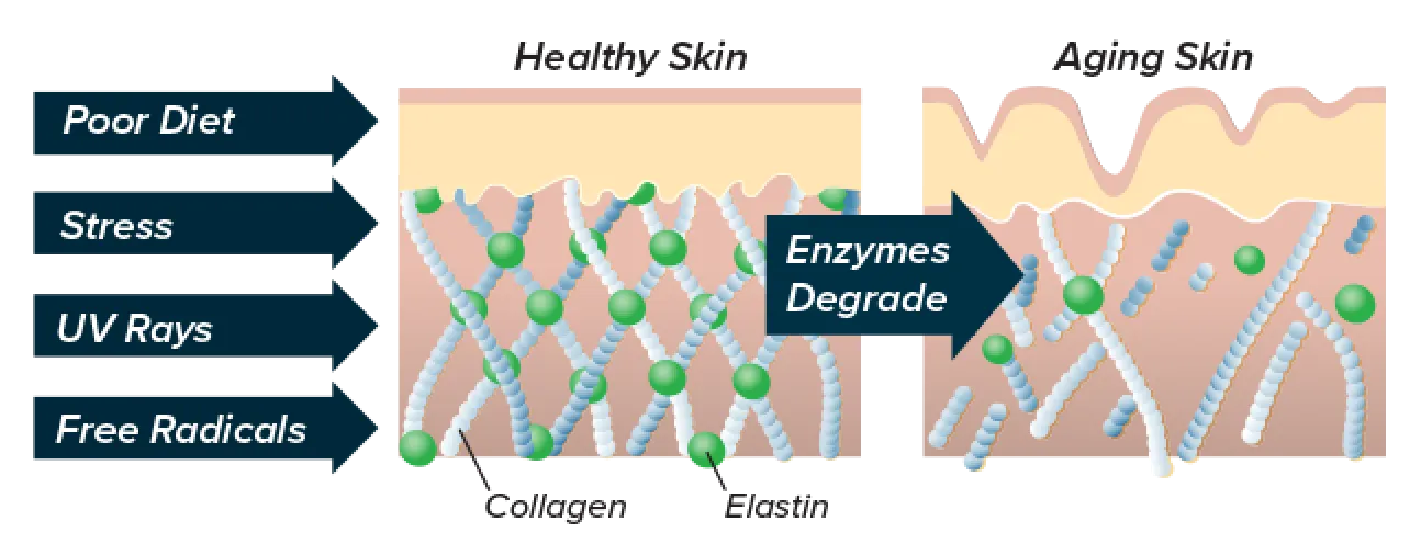 inflammation factors