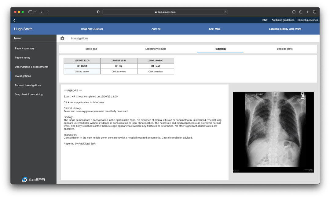 SimEPR | Simulated Electronic Patient Record for Healthcare Simulation