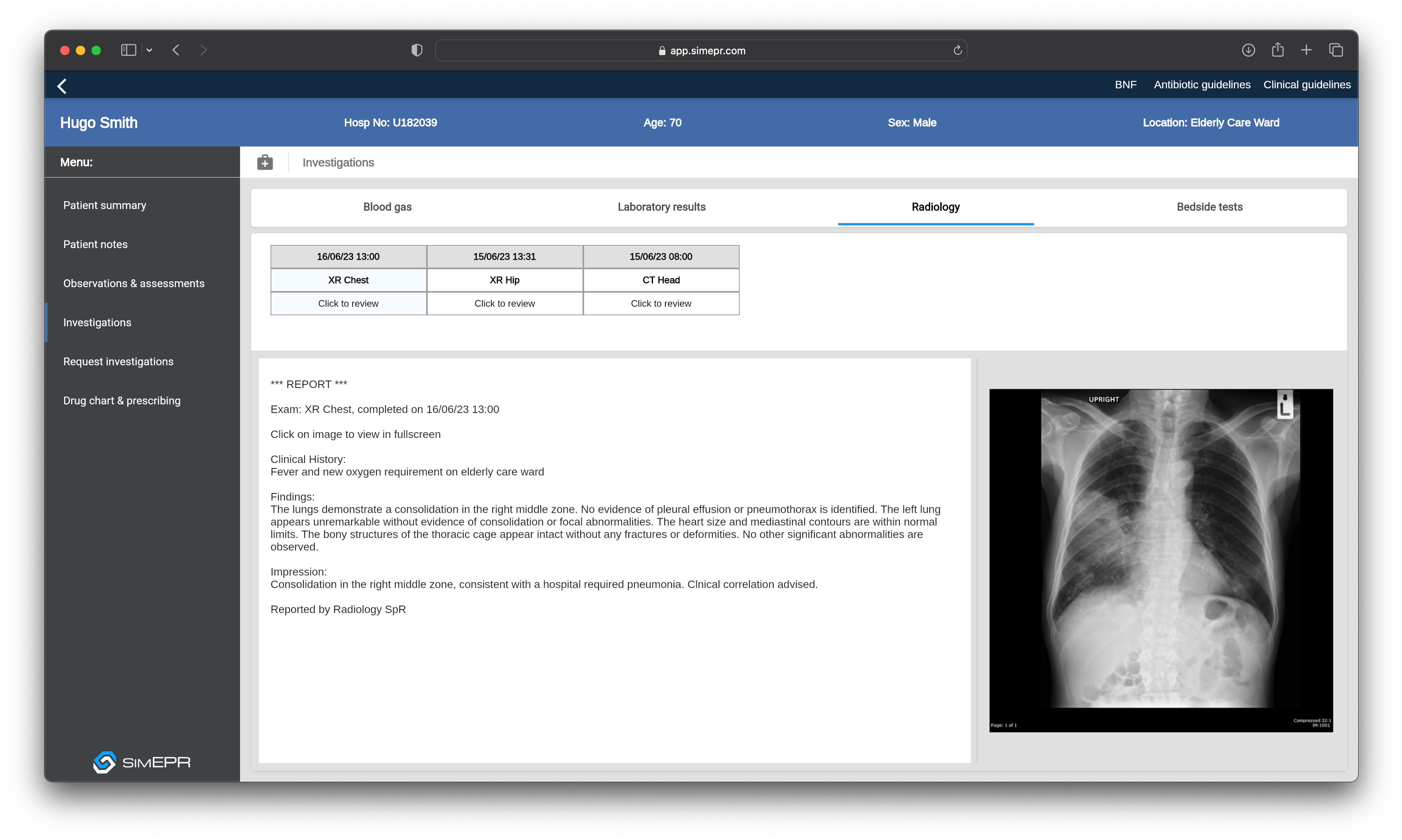 Screenshot of SimEPR app