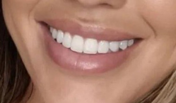 tooth and mirror tool