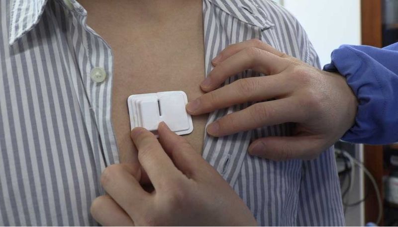 Implanated Pacemaker Boston Scientific Buys Wearable Cardiac Sensor Maker Preventice ...