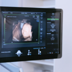 tela de computador com imagens e informações de exame de ultrassom gestacional