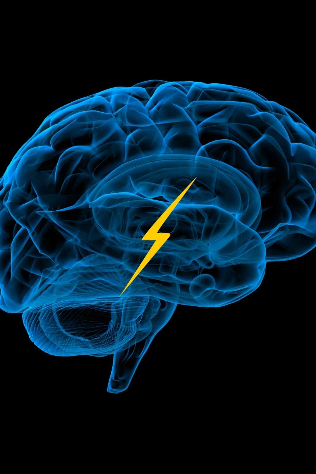 Electric Brain Rotating Stock Video