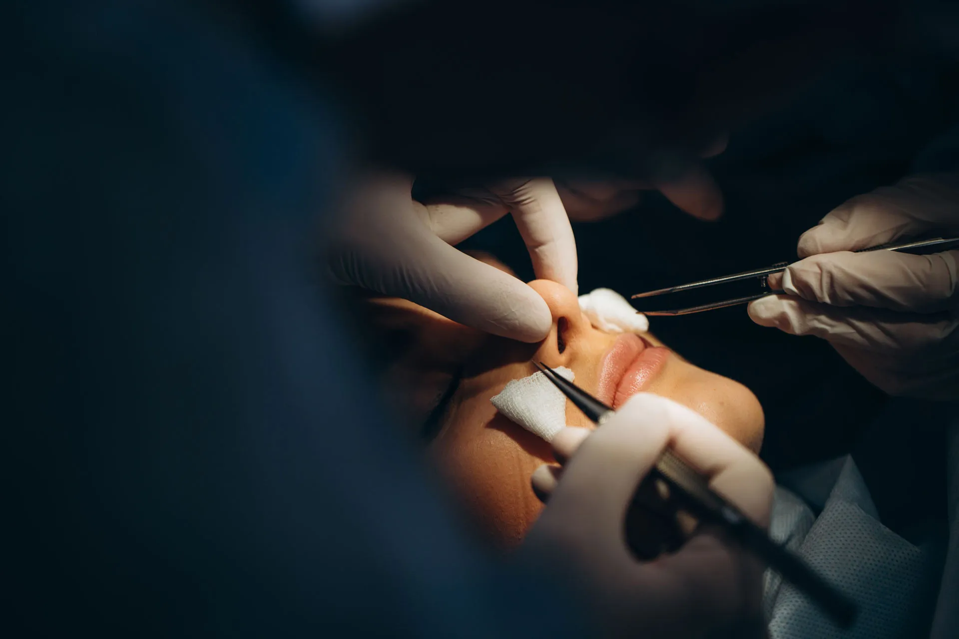 I don't have enough money for rhinoplasty, is rhinomodeling for me?