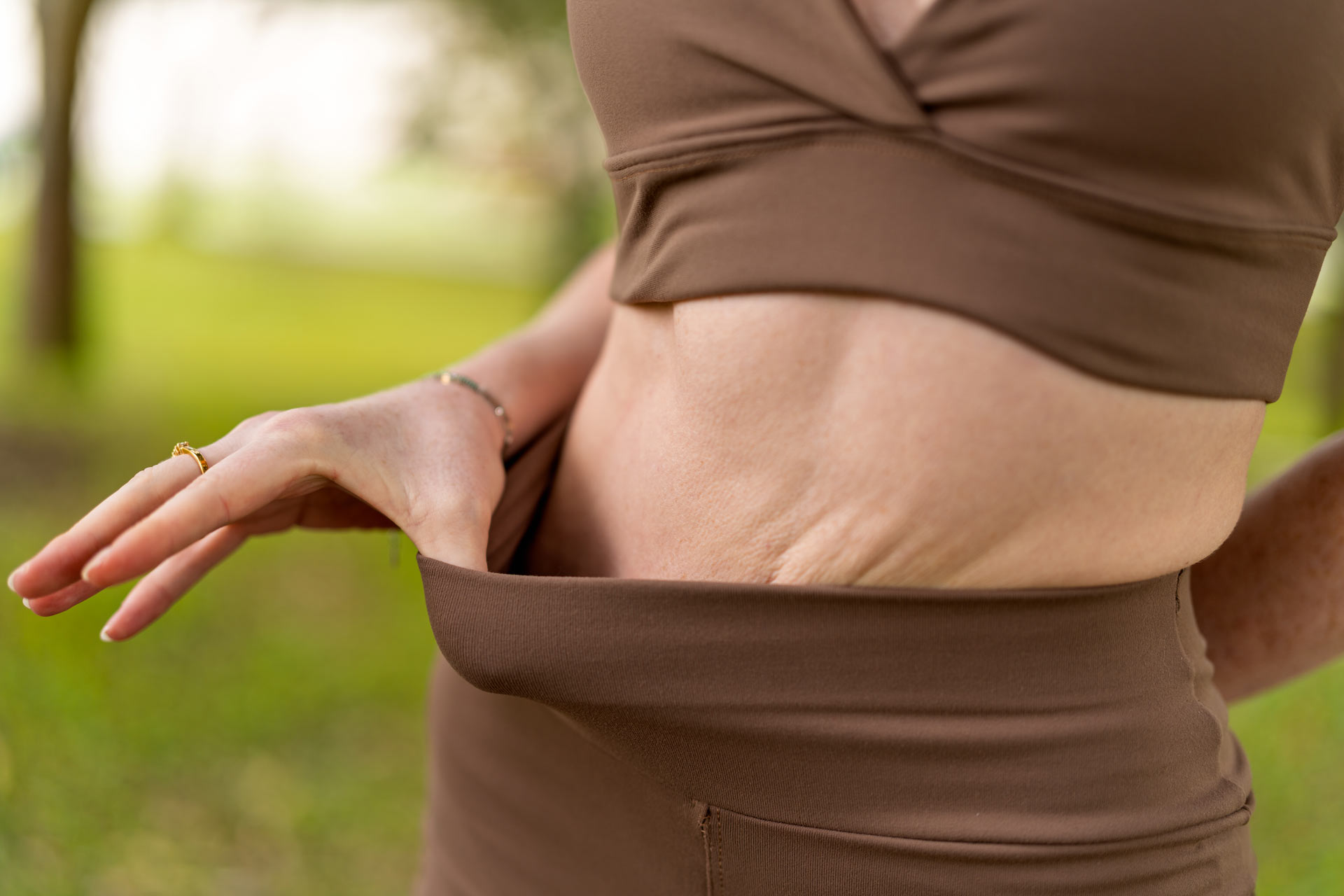 Cirugía plástica post-bariátrica: reconstrucción corporal después de una gran pérdida de peso