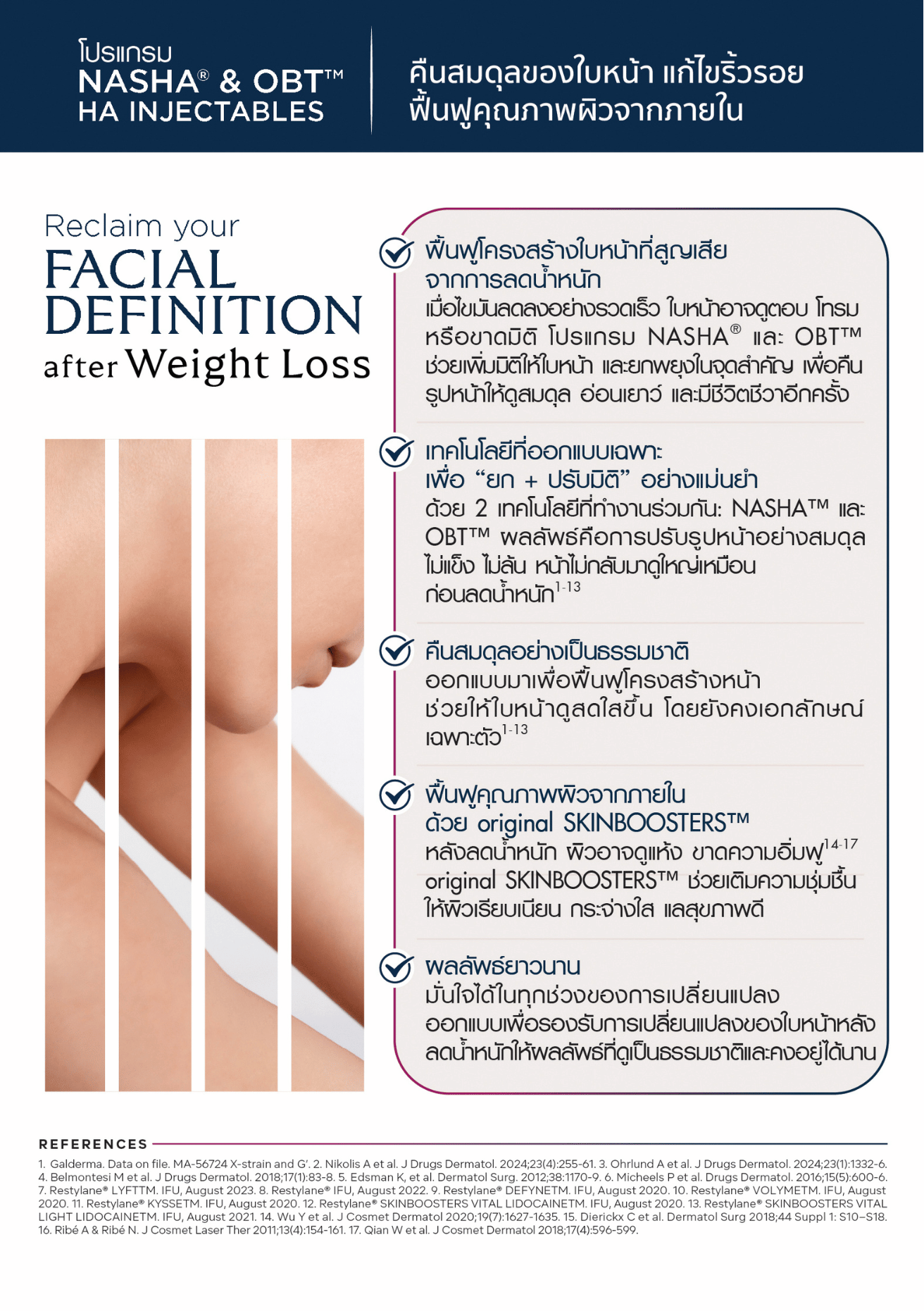 โปรแกรม NASHA® & OBT™ HA Injectables ช่วยฟื้นฟูโครงสร้างใบหน้า ปรับสมดุลรูปหน้า และเพิ่มความชุ่มชื้นให้ผิวหลังลดน้ำหนัก