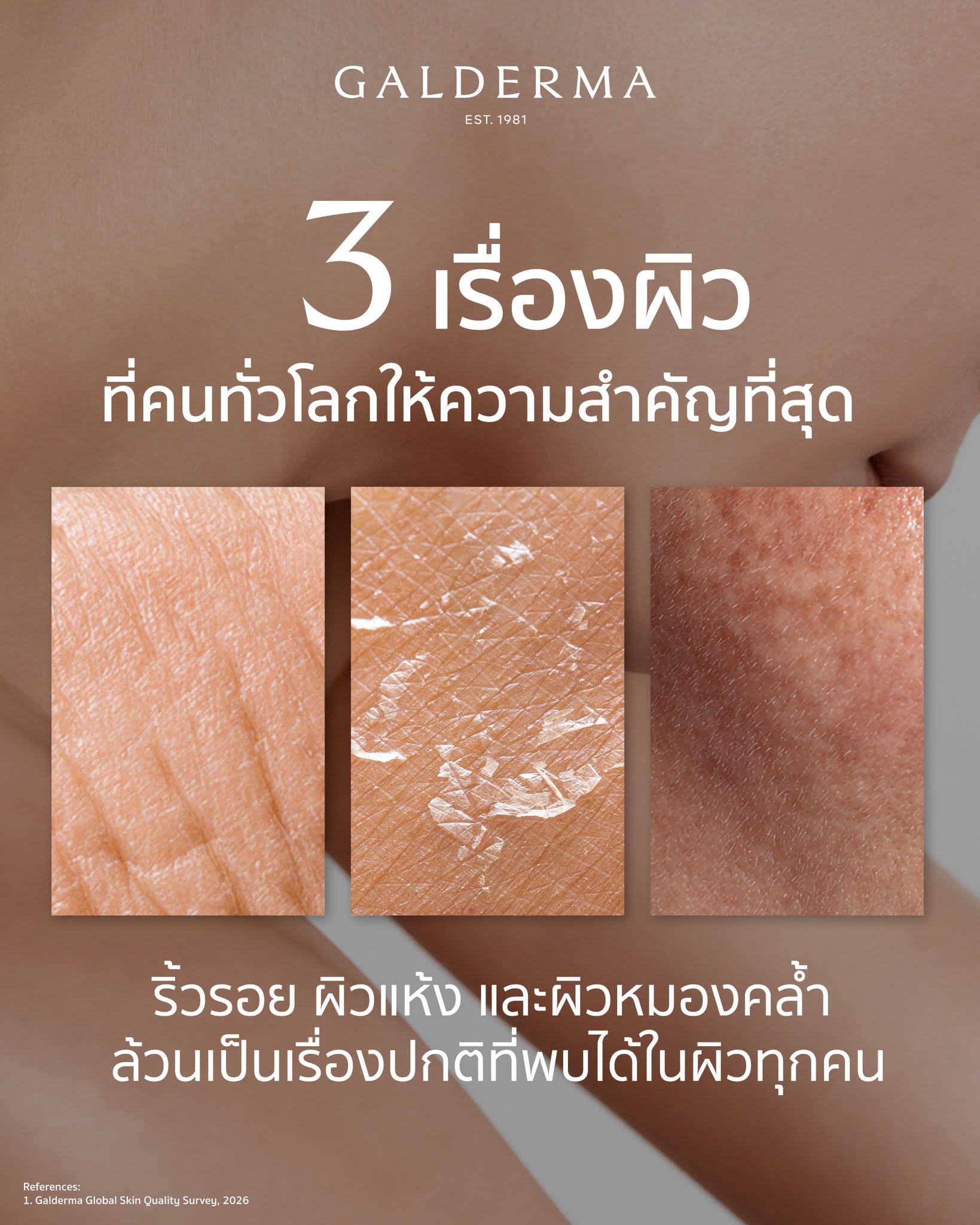 ภาพแสดง 3 เรื่องผิวที่พบได้ทั่วไป ได้แก่ ริ้วรอย ผิวแห้ง และผิวหมองคล้ำ