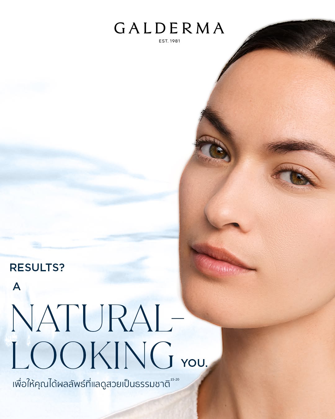 ภาพแนวคิดผลลัพธ์ที่ดูเป็นธรรมชาติ จากการเลือก NASHA® & OBT™ Dermal Filler ให้เหมาะกับแต่ละบริเวณบนใบหน้า