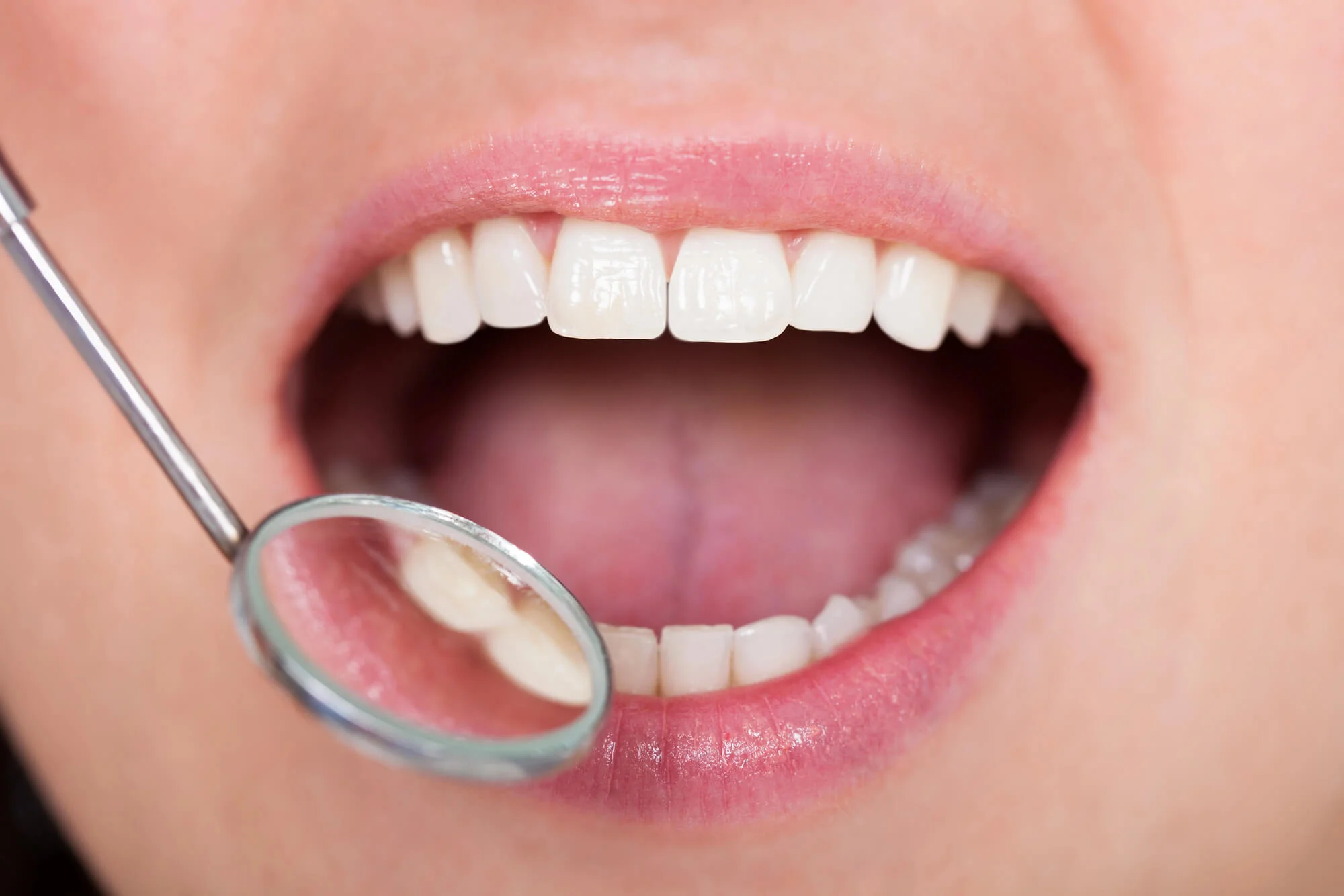Gentle oral exam special needs dentist
