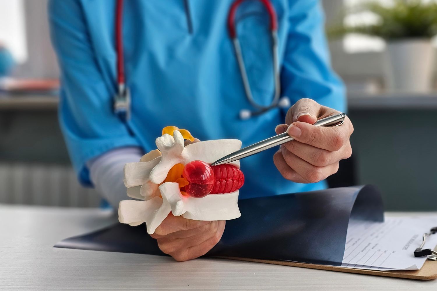 Doctor explaining spinal pain with a model.