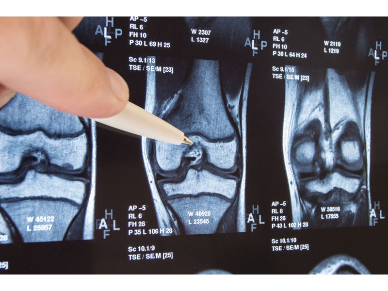 A finger points to a knee MRI scan image.