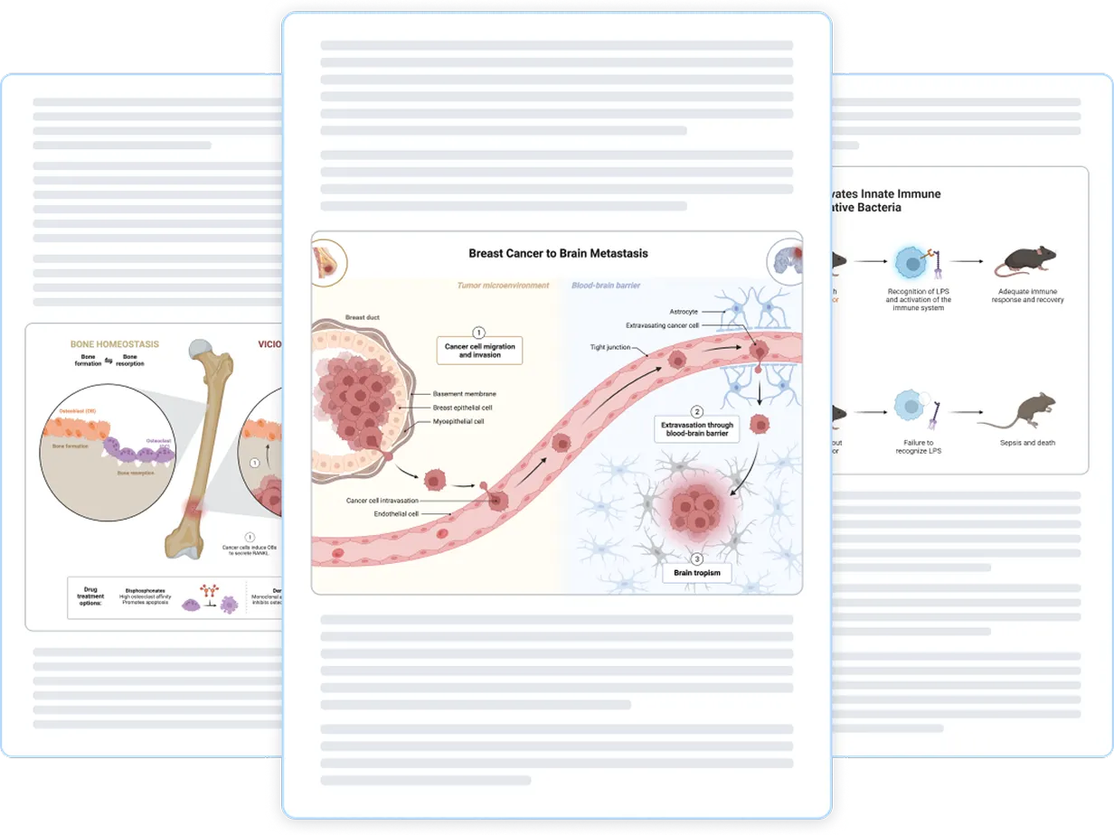 Scientific illustration showing breast cancer progression to brain metastasis, detailing cancer cell migration from breast duct through blood-brain barrier to brain tropism, with labeled cells and barriers.