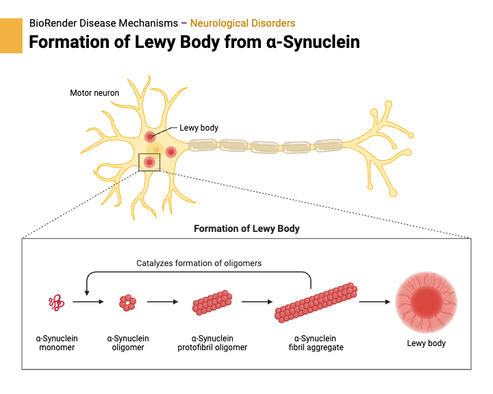 Formation Of Lewy Body From Synuclein BioRender Science Templates