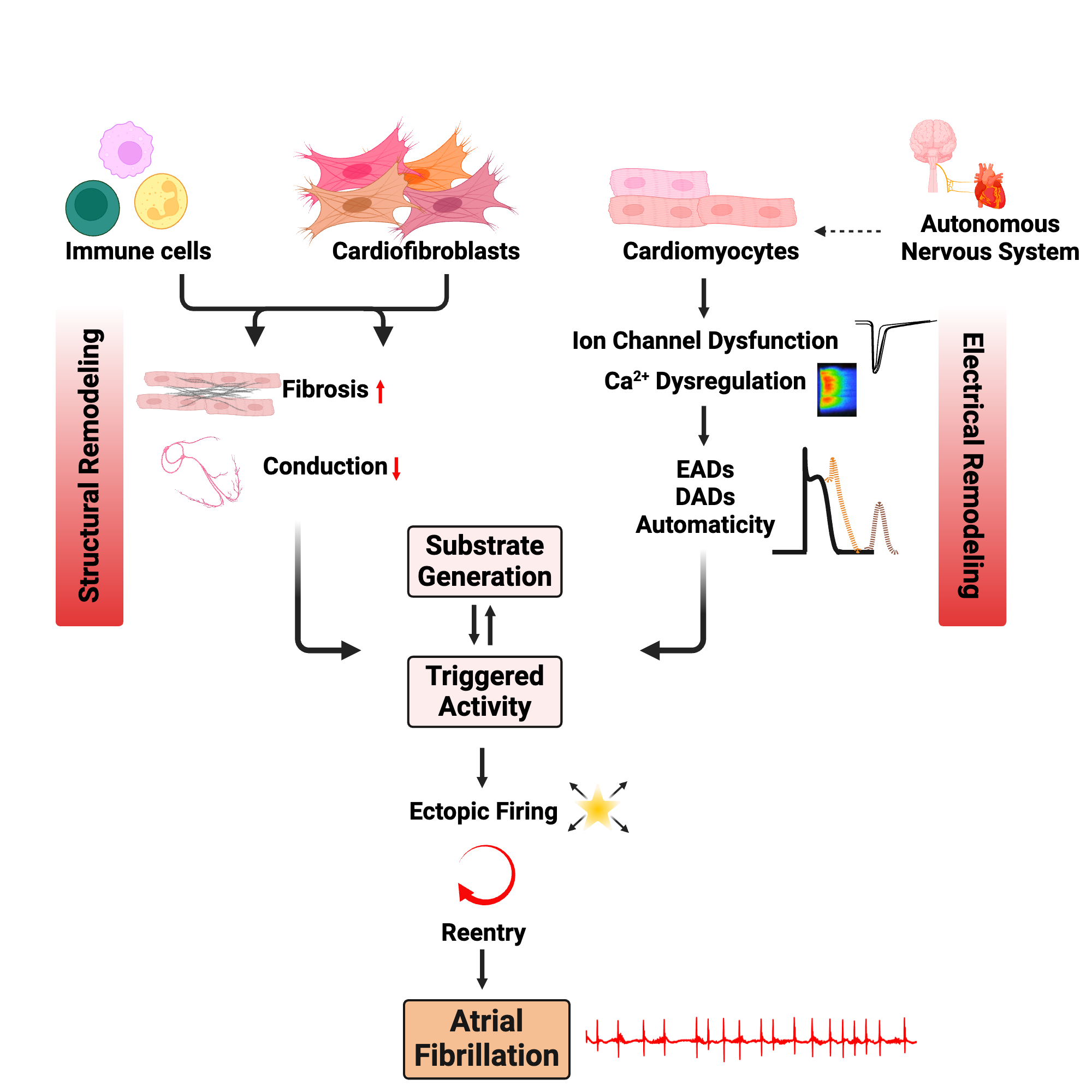 An editable high resolution scientific image depicting Mechanisms of Atrial Fibrillation