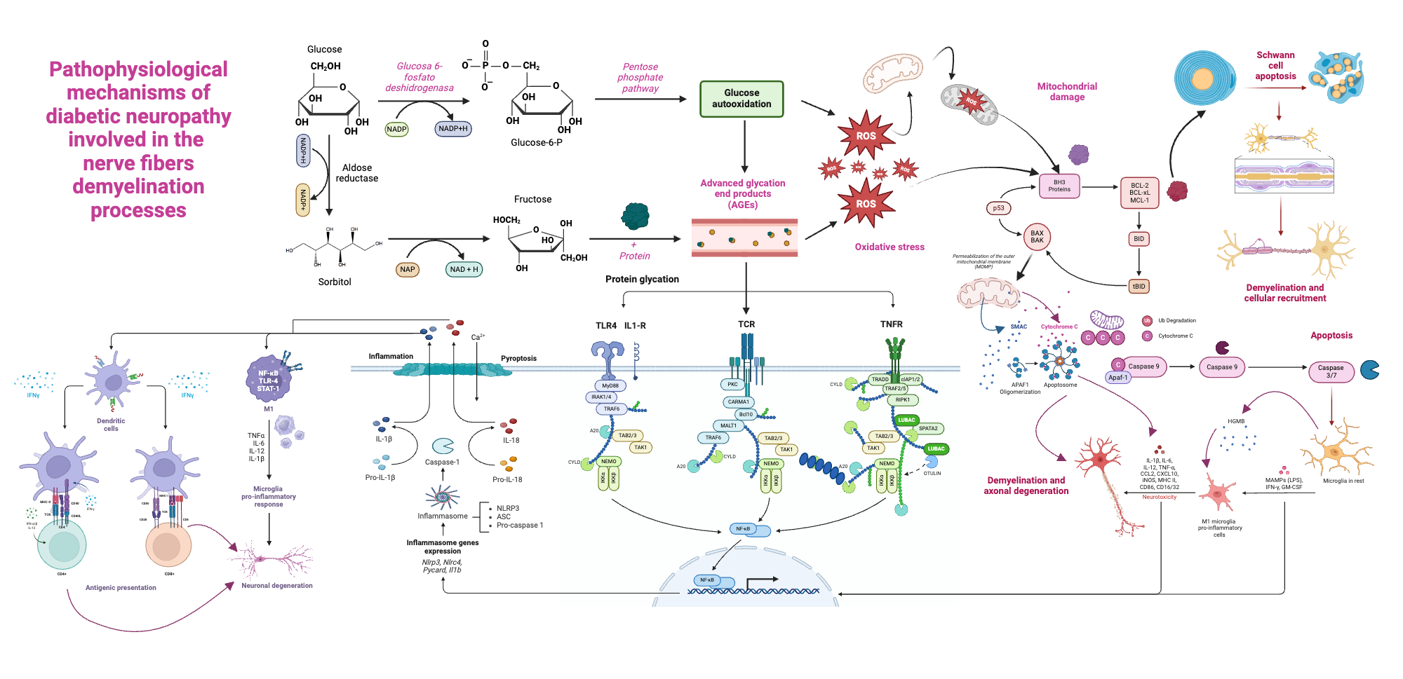 An editable high resolution scientific image depicting Pathophysiological mechanisms of diabetic neuropathy immunitary response
