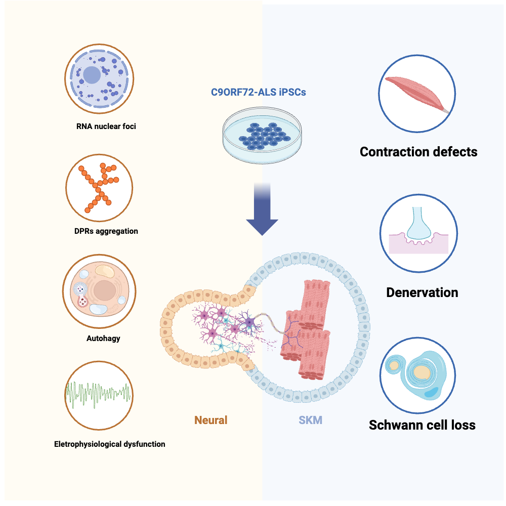 An editable high resolution scientific image depicting Pathological feature of the organoids to ALS