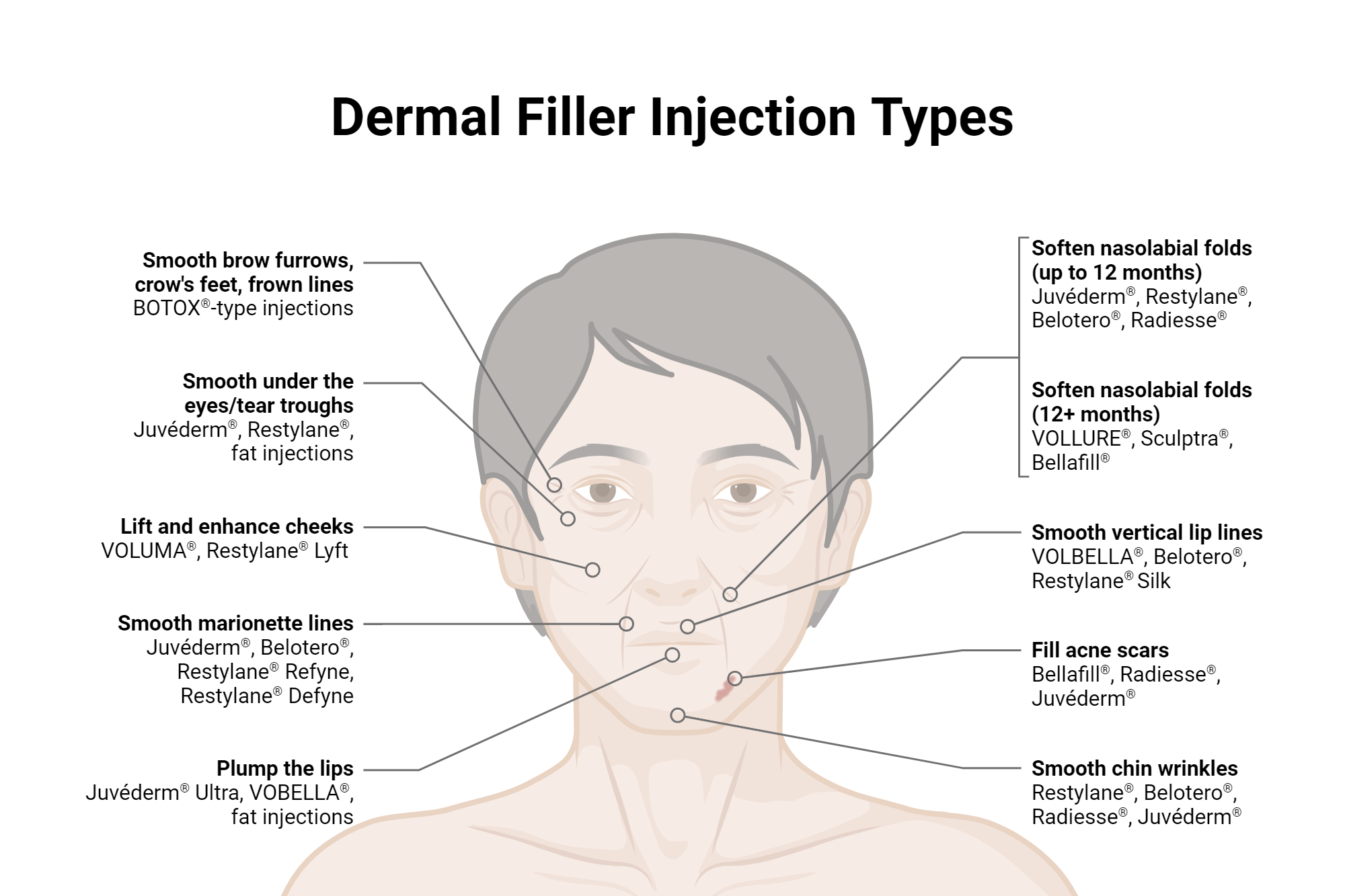 Dermal Filler Injection Types BioRender Science Templates Dermal Filler Injection Types BioRender Science Templates