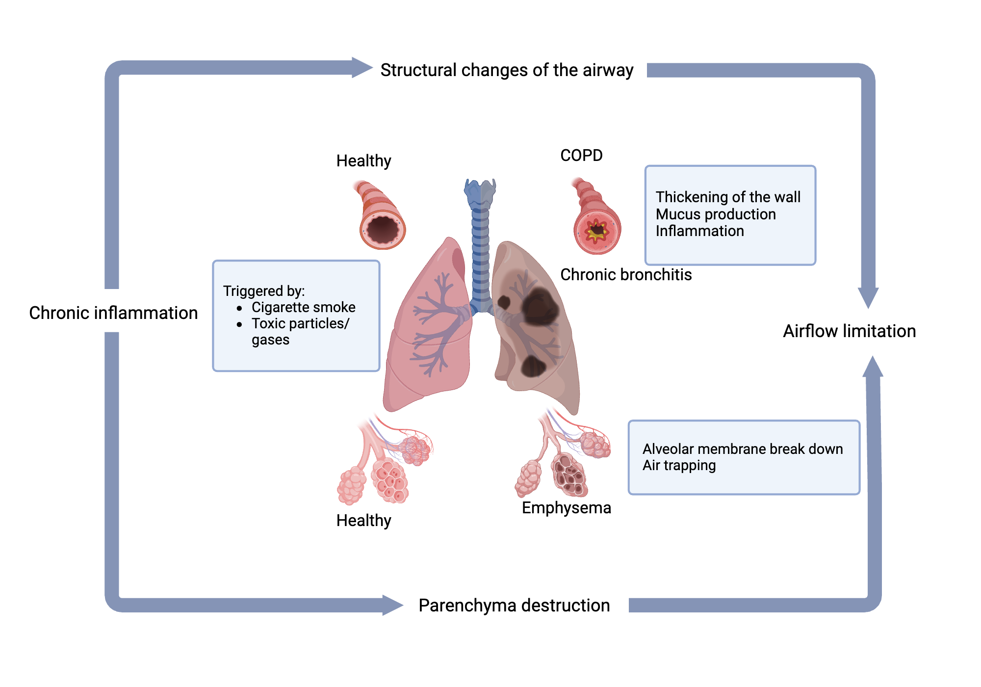 An editable high resolution scientific image depicting COPD Schematic