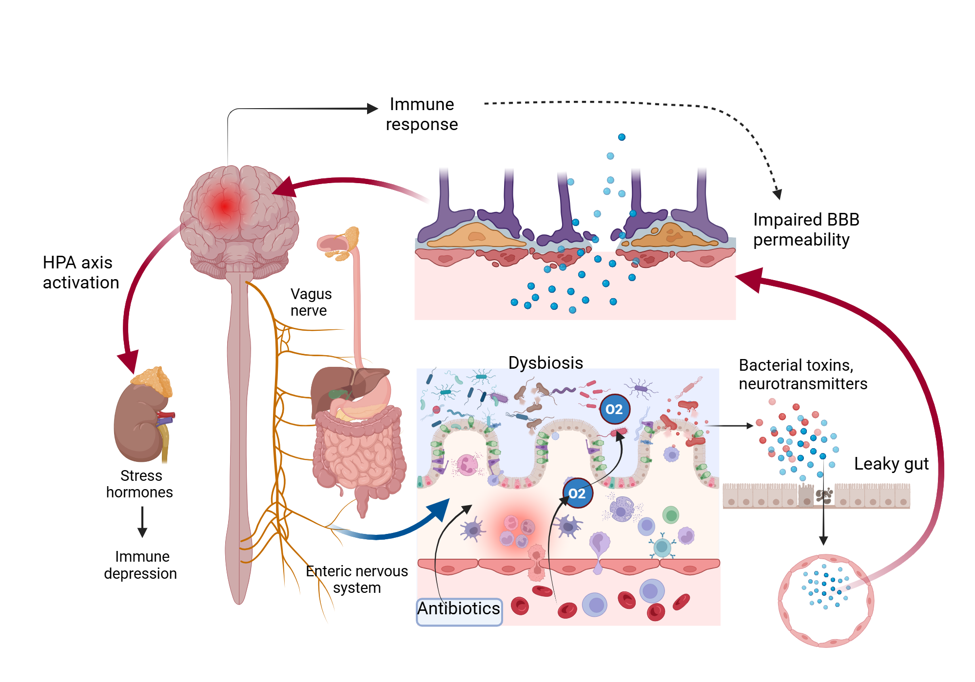 An editable high resolution scientific image depicting Gut brain axis dysruption in traumatic brain injury