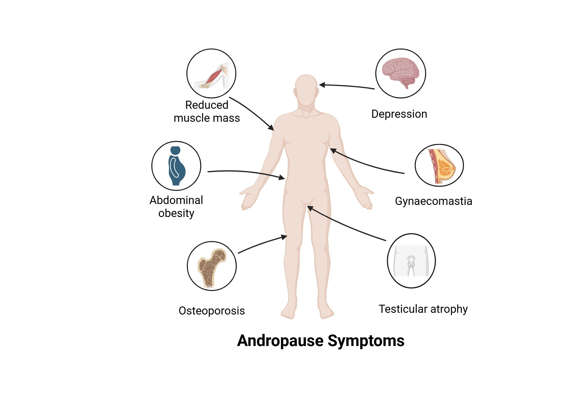 An editable high resolution scientific image depicting Andropause