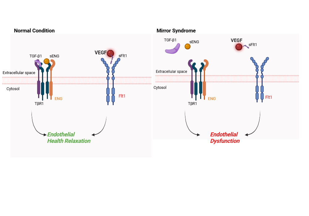 An editable high resolution scientific image depicting Mirror syndrome - endothelial dysfunction