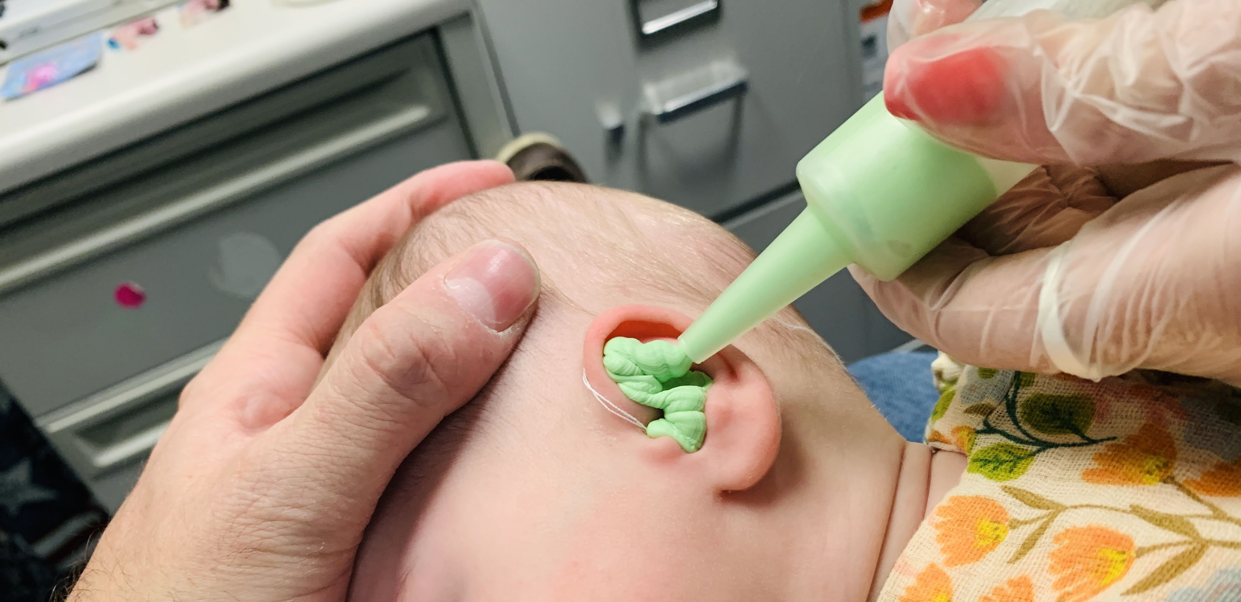 5-month old infant having ear mold impressions taken at pediatric audiologist