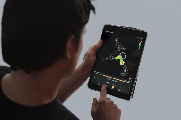 Ankyras patient-specific flow diverter planning