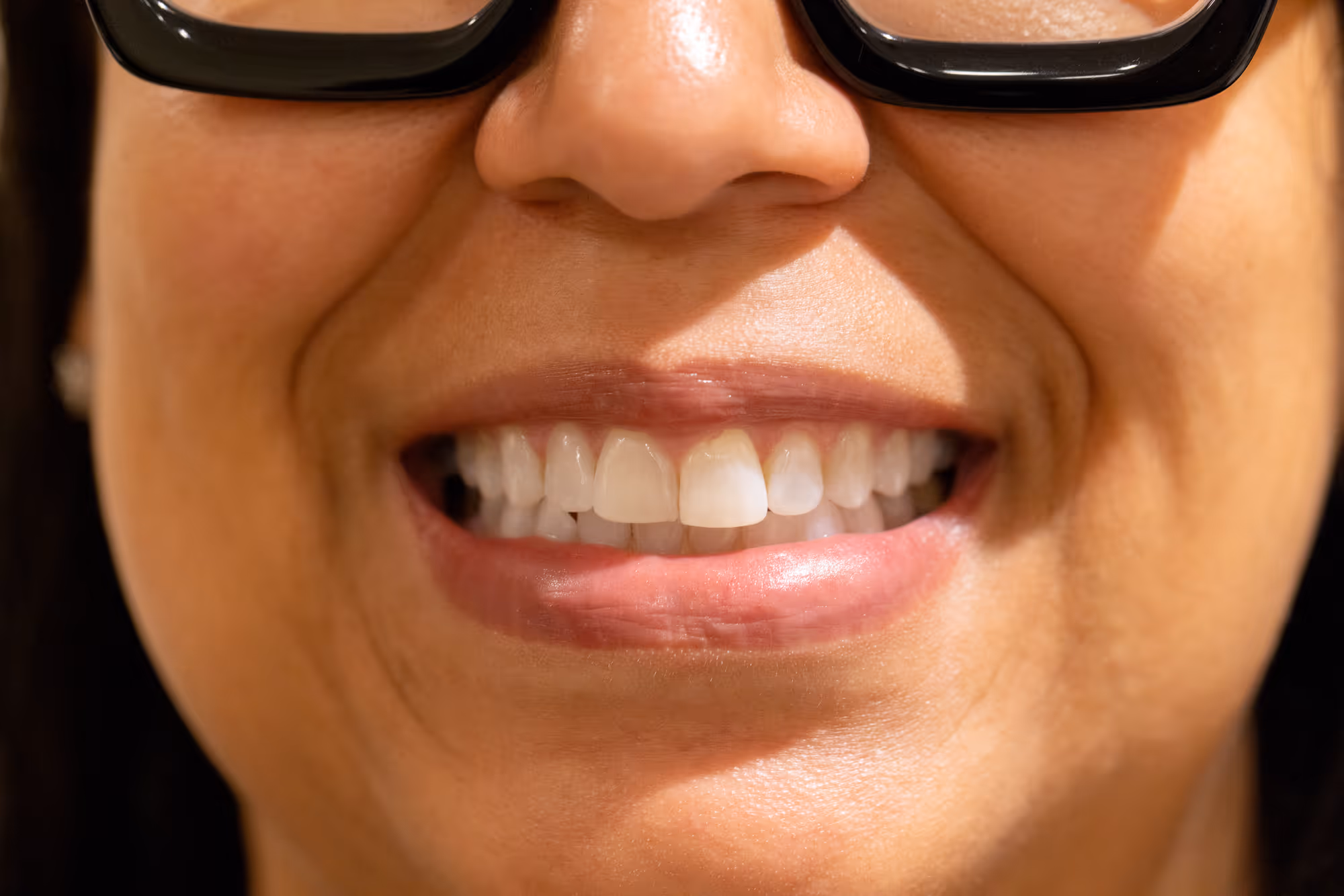 Professional teeth whitening methods - Teeth whitening Zionsville, IN - Holland Dental