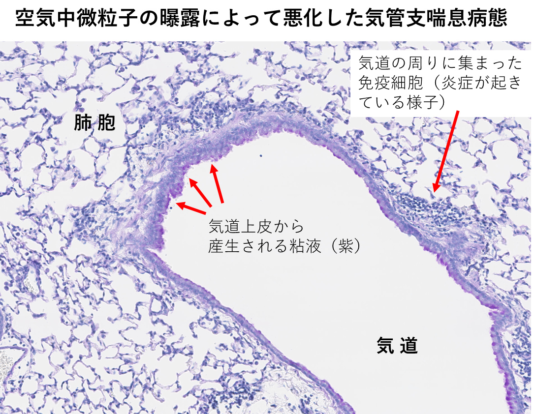 採取した粒子成分の測定をして、細胞の炎症と各成分の相関関係について検証を行った。様々なPM2.5を曝露させた結果、炎症反応の悪化に関して、チタンが影響規定成分の1つである可能性を発見した。実験動物で炎症を誘導するタンパク質であるIL-6の産生について調べた結果、チタン濃度が高いとIL-6が多く、気道の炎症を引き起こすことが確かめられた。また、マウスの肺の中でのチタンの分布を顕微鏡で観察すると、炎症が強いところに集中していることも分かった。肺の中の免疫細胞であるマクロファージの中にチタンが含まれていた。