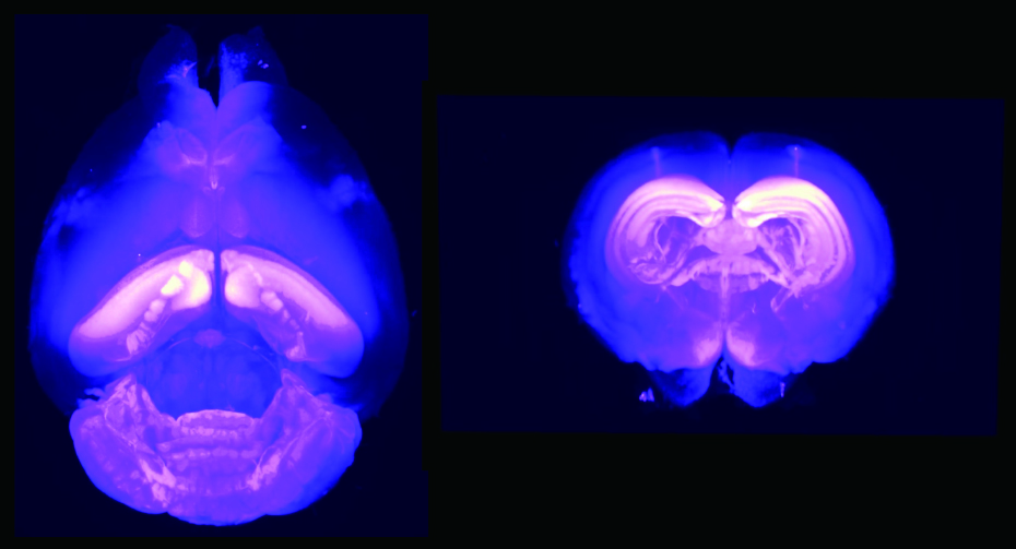 細胞表層へ提示された活性なAMPA受容体のマップ。