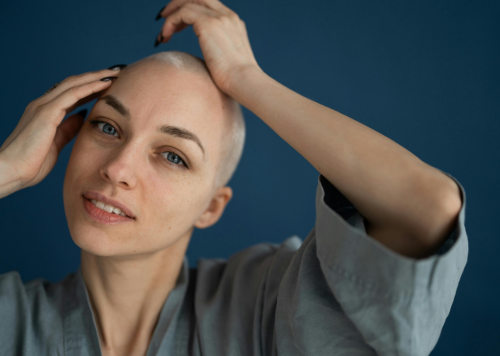 What Causes Alopecia In Women? Types, Causes & Treatment | Juniper