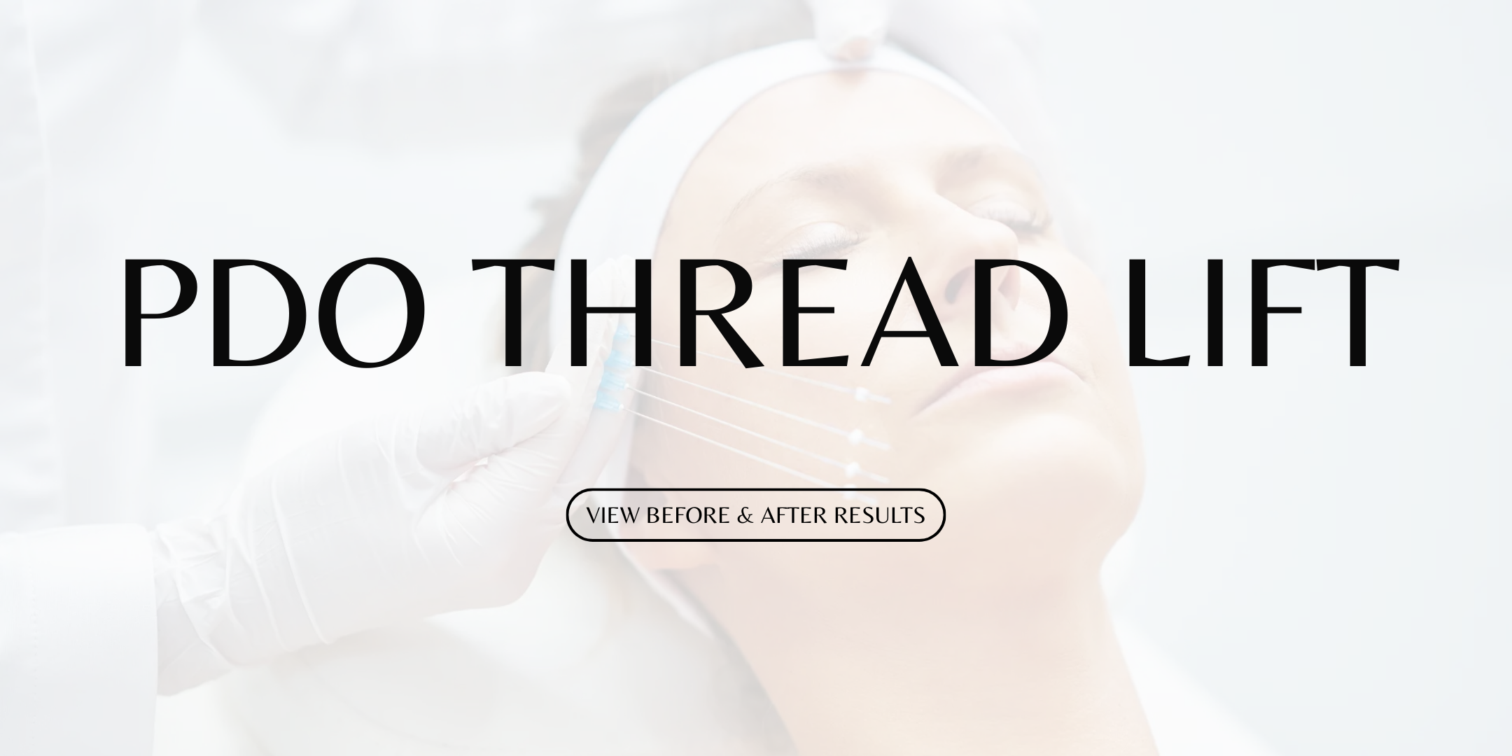 PDO Thread Lift Cover Photo