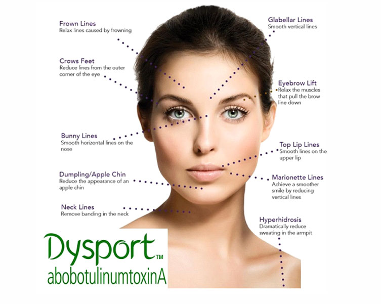 Double Your Savings! Earn 2X ASPIRE Rewards on Dysport® This November