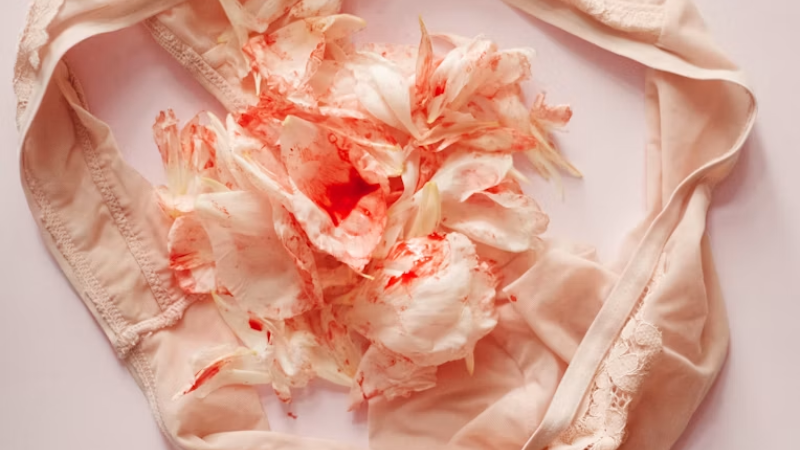 Ciclo Menstrual Irregular: Qué es y cuáles son sus causas