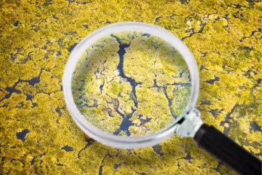 Pathogens in dirty water