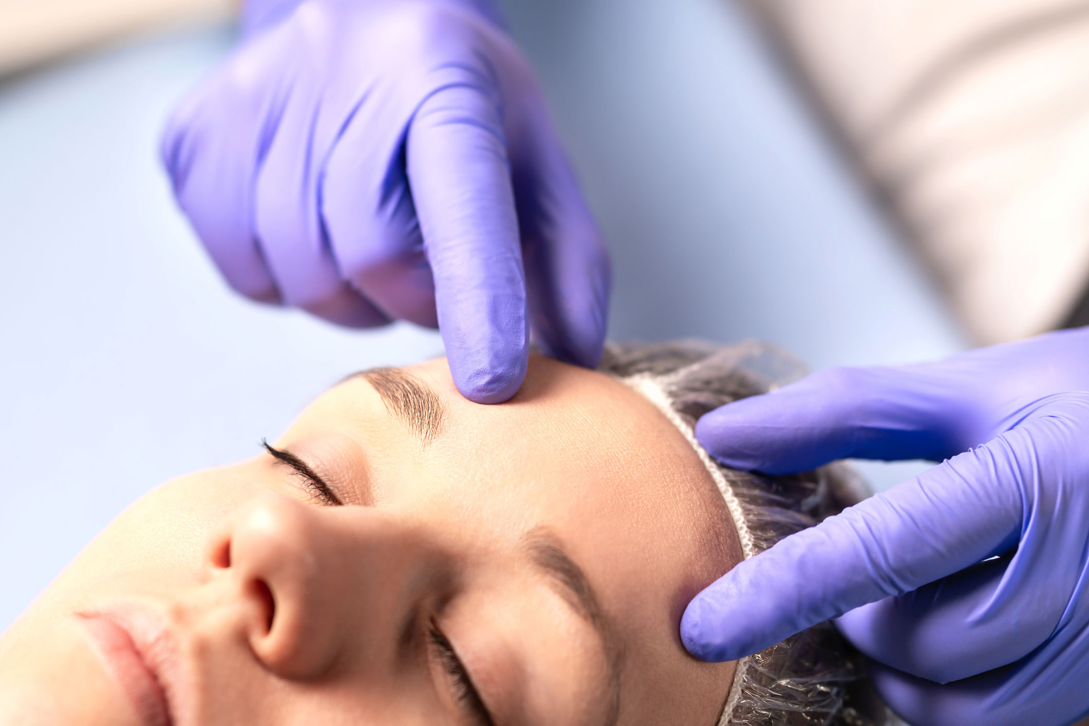 dermal-fillers-facial-fillers-pre-treatment-routine-edmonton