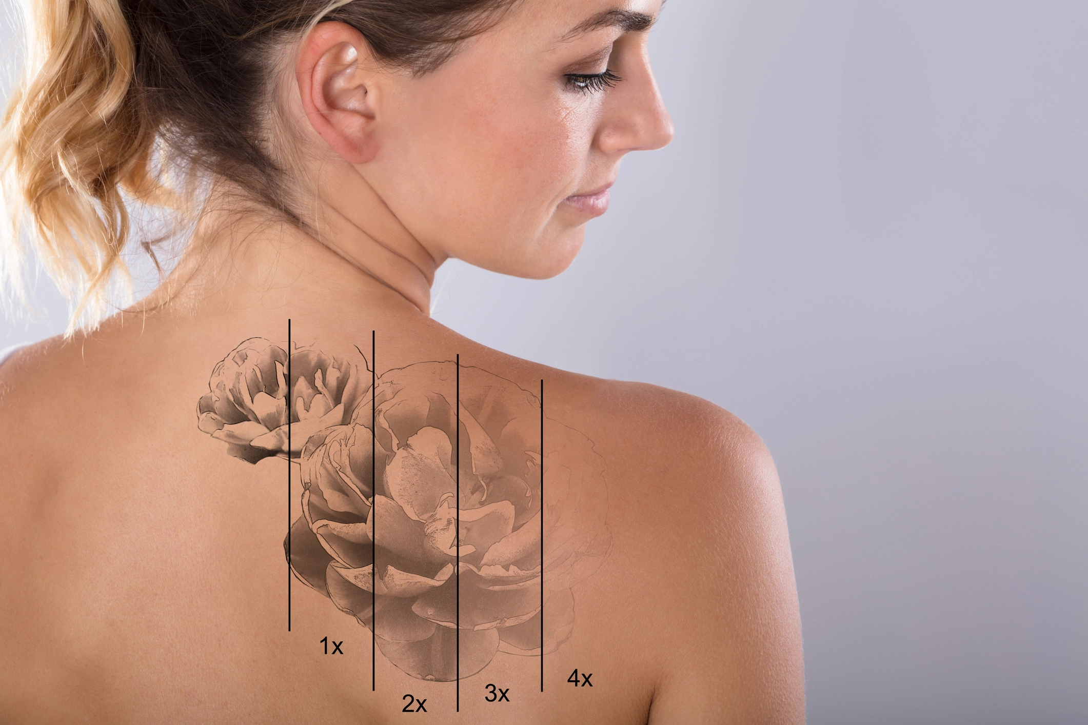 botox dysport post-treatment routine edmonton