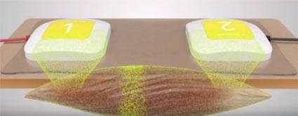 Trusculpt applicators on body