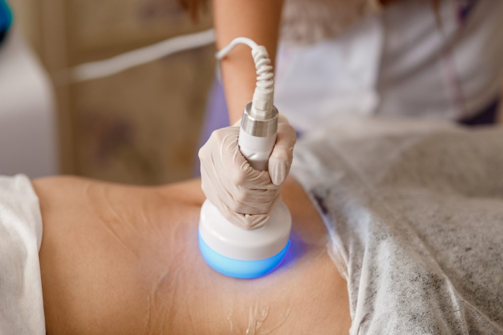 trusculpt calgary