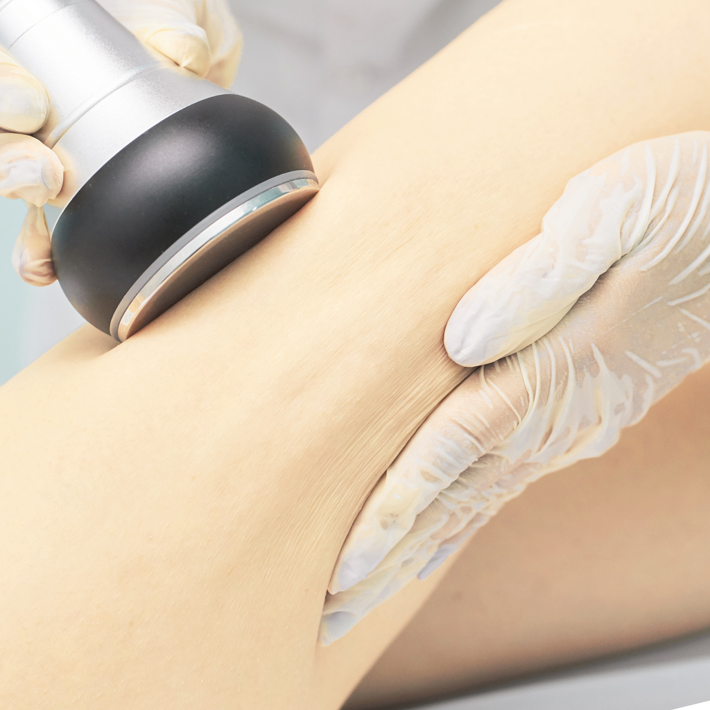 Cavitation rf body treatment. Female ultra sound lipo machine. Spa contouring. Doctor hands