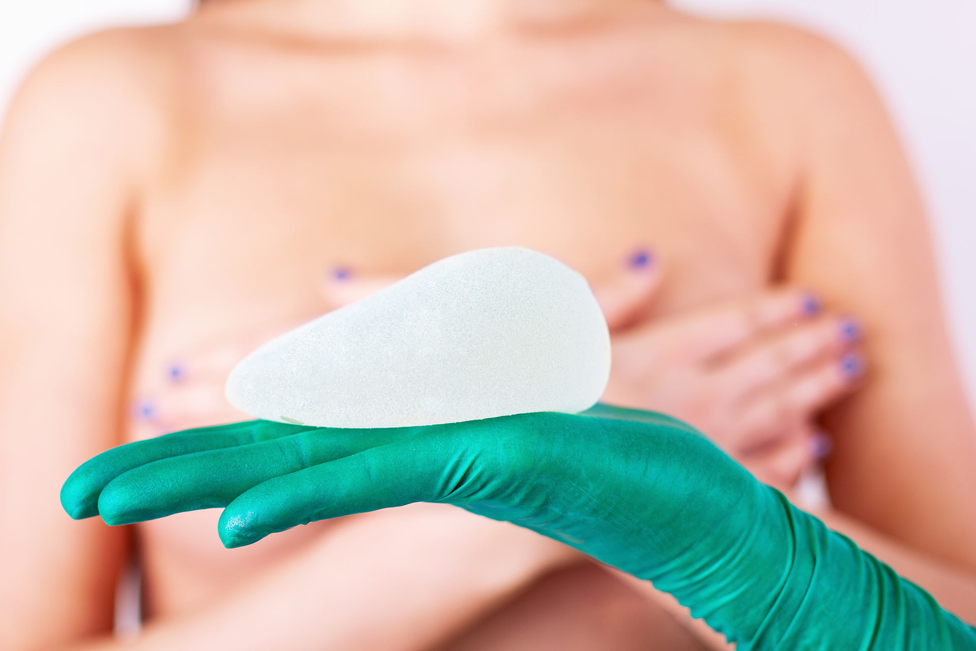 Implantes mamarios redondos o anatómicos ¿cuál es para mí?