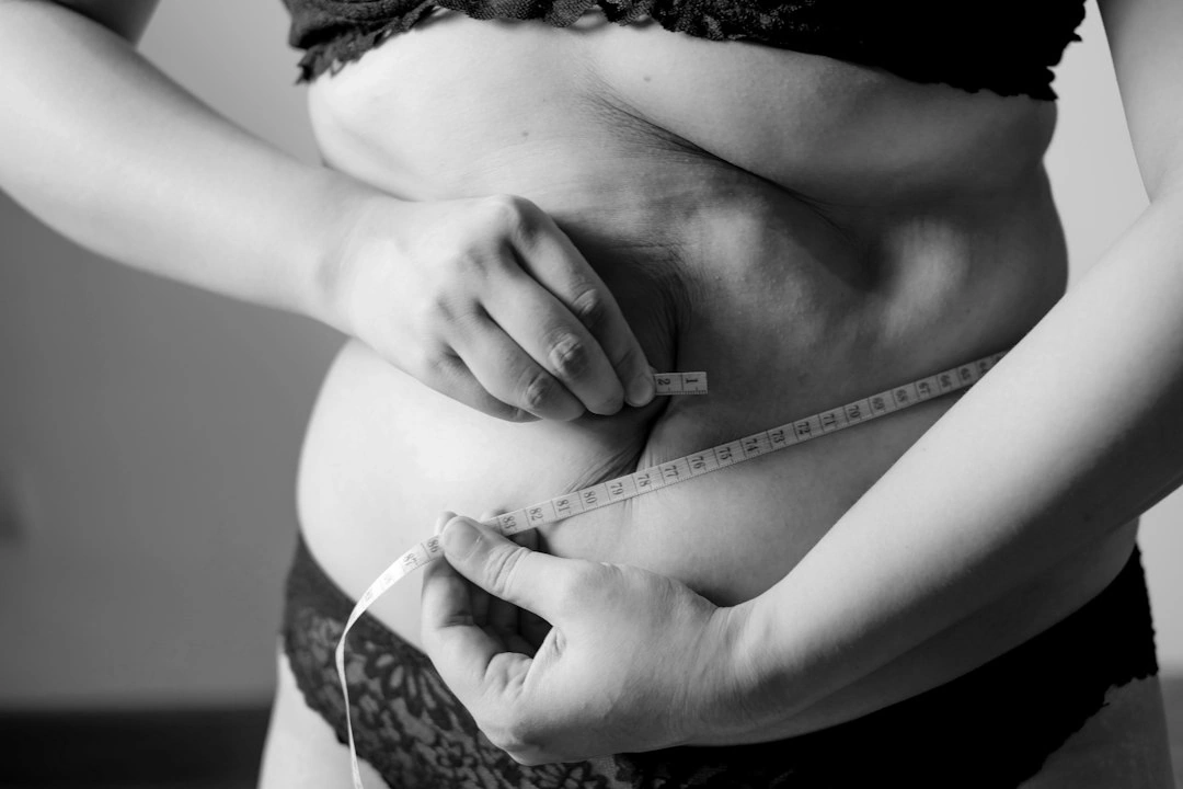 CoolSculpting stomach treatment CoolSculpting stomach treatment