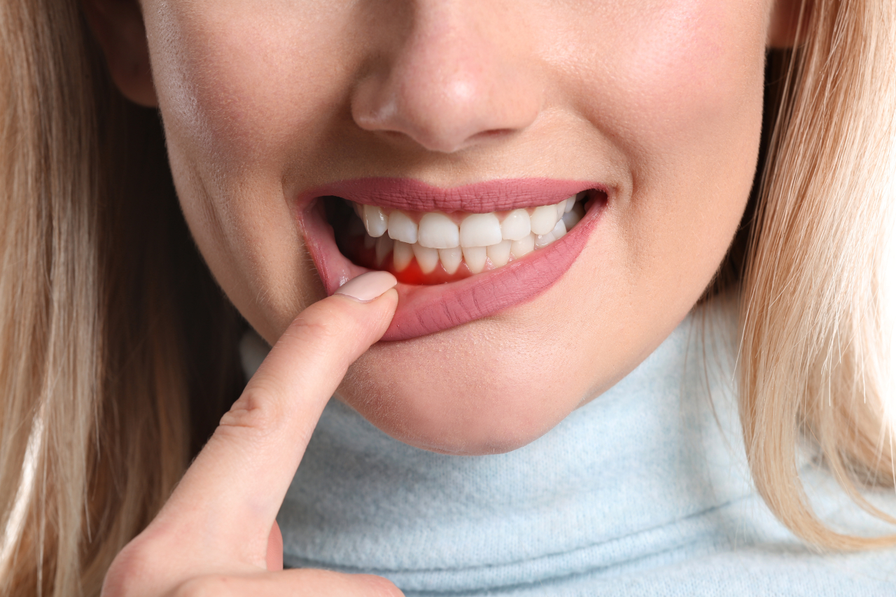 How Gum Disease Treatment Can Protect Your Smile and Overall Health