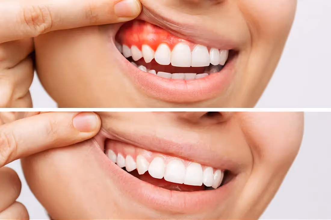 tooth and mirror tool