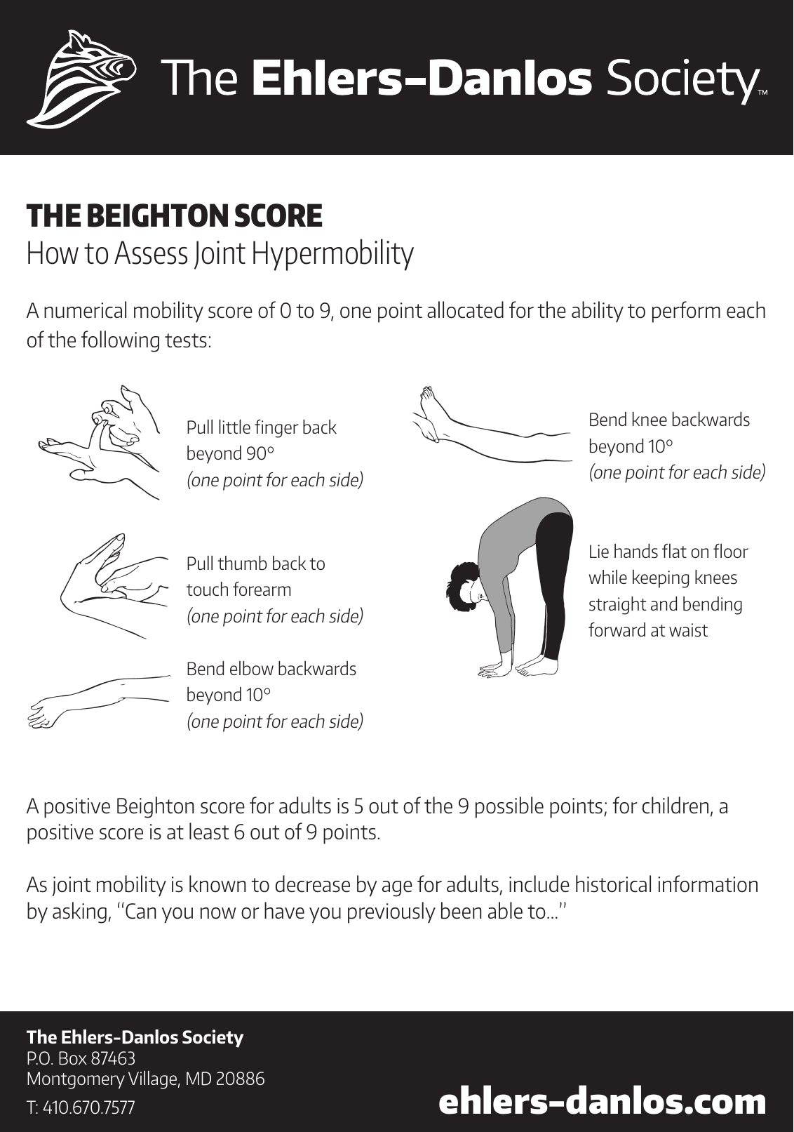Beighton Hypermobility Score PDF assessment form for joint hypermobility