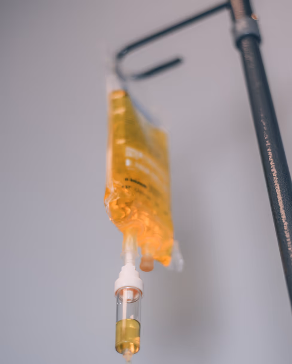 A yellow bag of fluid hangs from a metal pole.